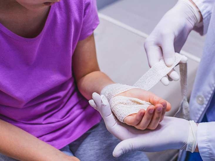 Te tay canh bao benh anh 2