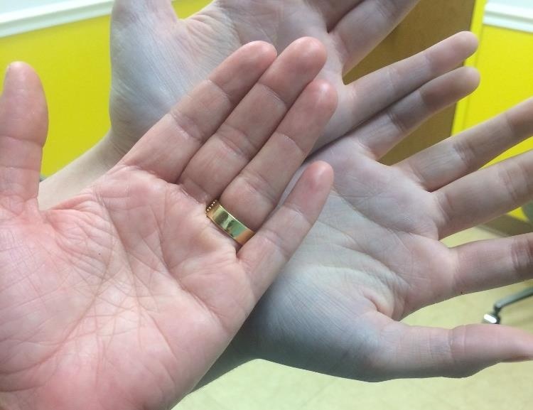 Te tay canh bao benh anh 5