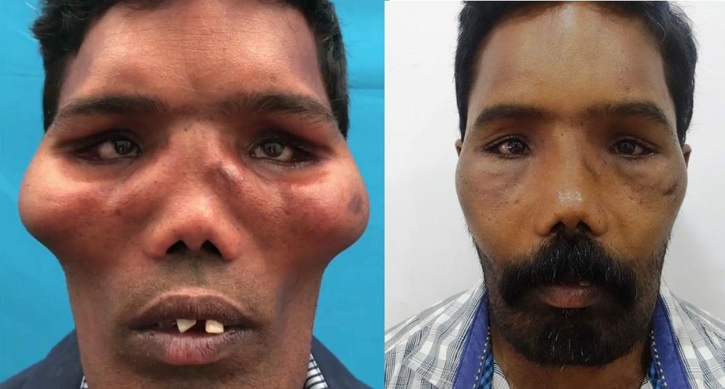 Bi coi la quai vat vi mang khuon mat 'su tu' suot 23 nam hinh anh