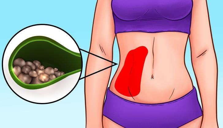 Dau hieu dau bung nguy hiem anh 8