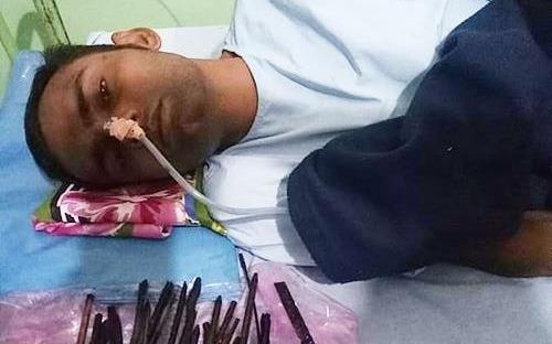 Chang trai nuot hang chuc con dao, luoi lam vao bung hinh anh