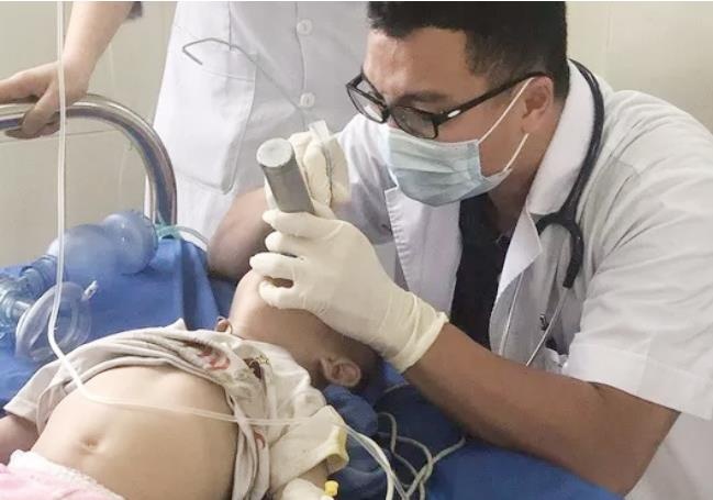 Chua tieu chay bang thuoc phien, be trai 12 thang tuoi nguy kich hinh anh