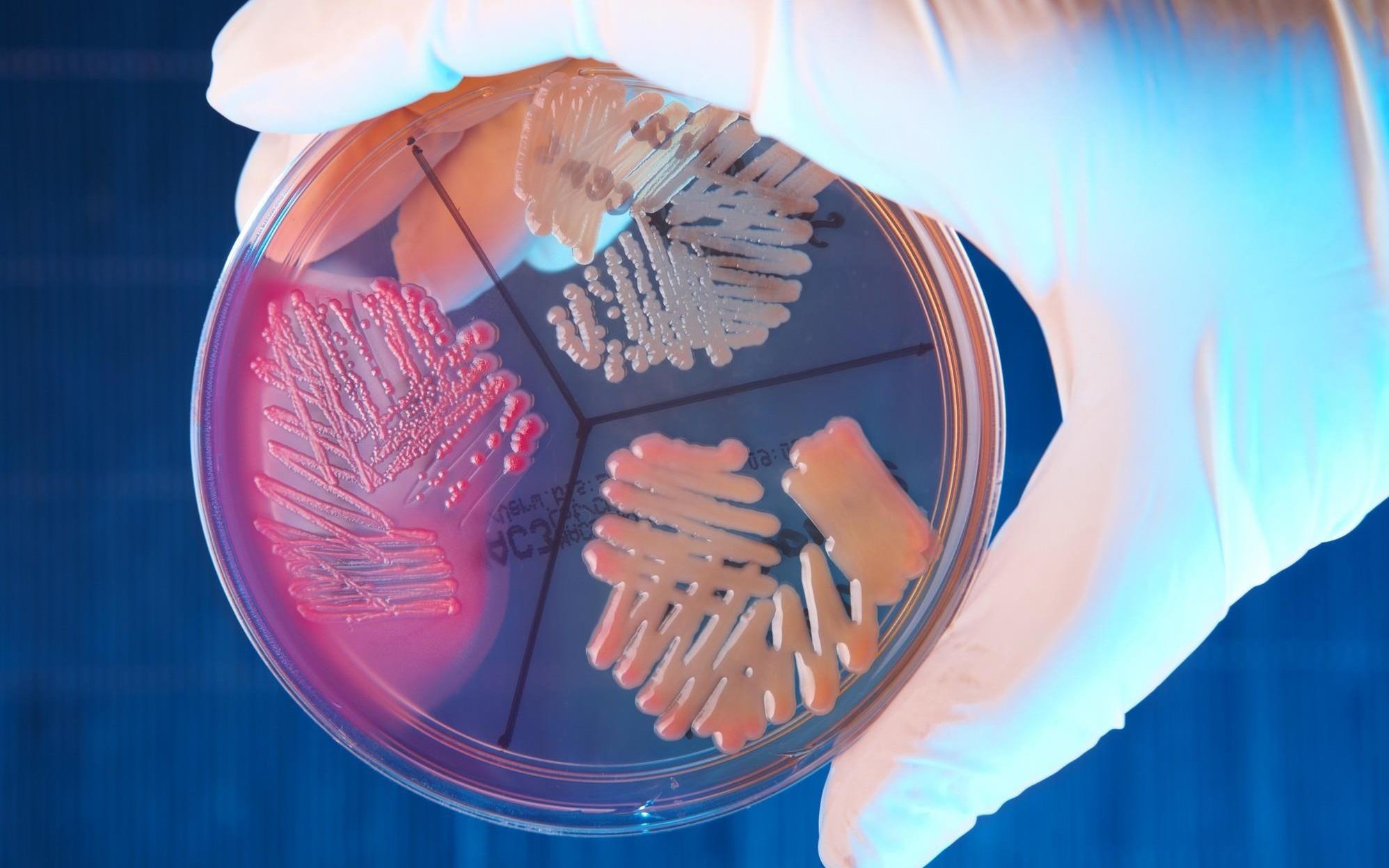 Phat hien co che khang thuoc cua vi khuan hinh anh