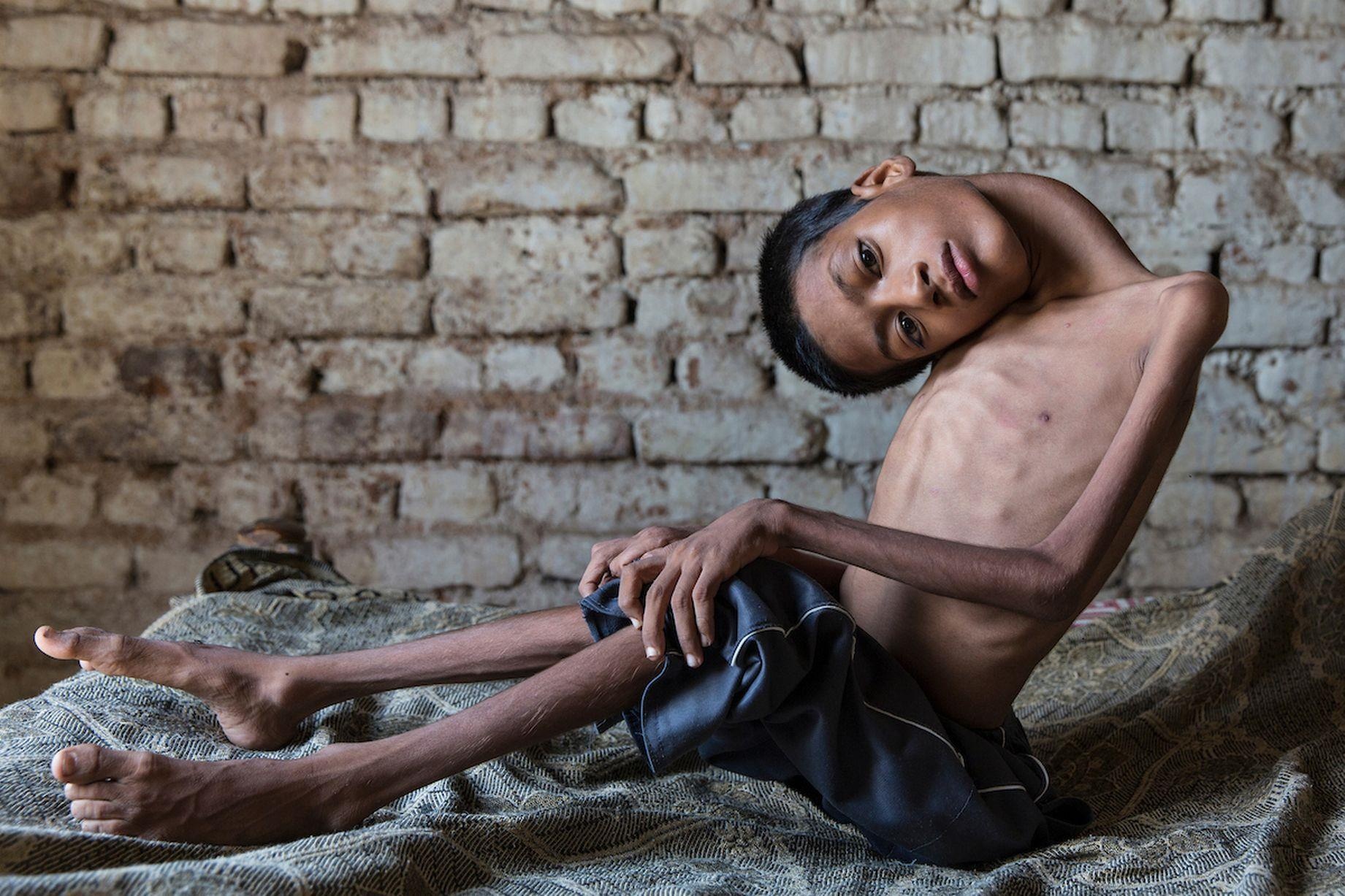 Cậu bé nhìn thế giới lộn ngược ảnh 1 Cau be nhin the gioi lon nguoc anh 1