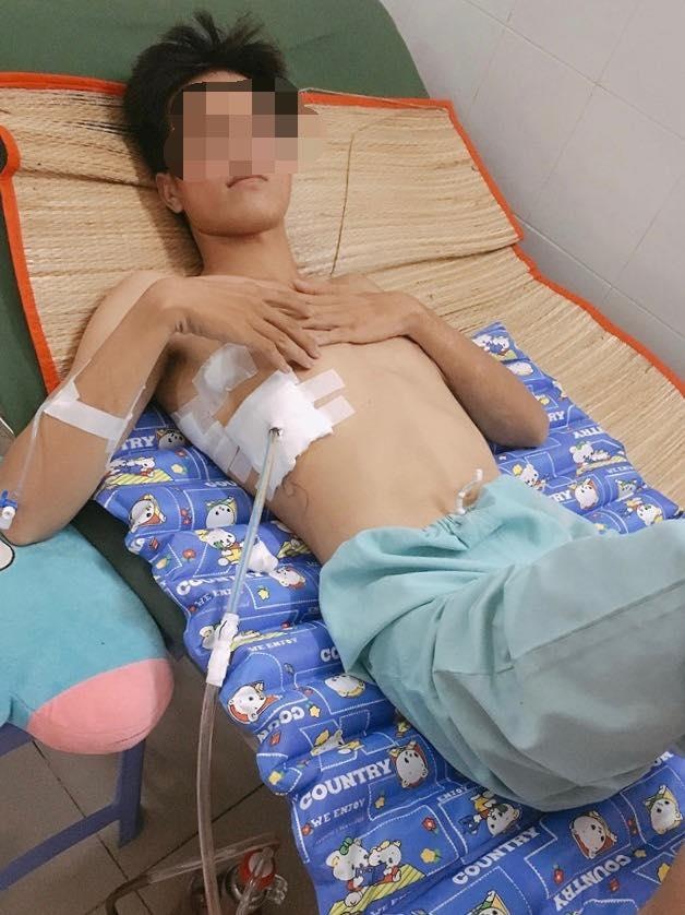 10 ngày 3 lần mổ vì thuốc lá ảnh 1 10 ngay 3 lan mo vi thuoc la anh 1