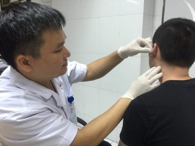 Biến dạng tai vì xỏ khuyên ảnh 2 Bien dang tai vi xo khuyen anh 2