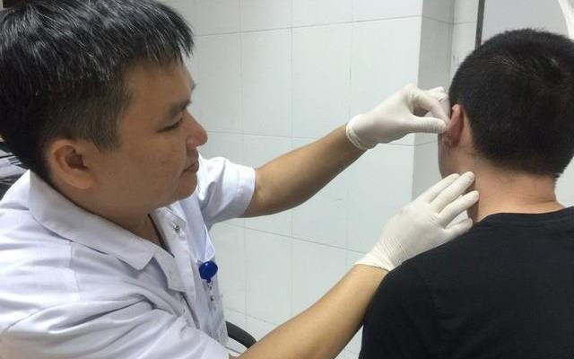 Deo khuyen tai cho 'ngau', nam sinh kho so vi seo loi hinh anh