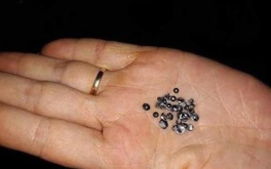 Lay 39 vien dan tu che trong dau benh nhan hinh anh