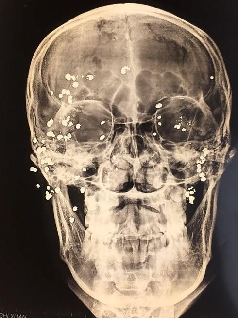 39 vien dan tu che trong dau anh 1