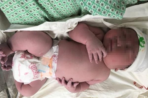 Bé sơ sinh nặng 5, 2 kg ảnh 1 Be so sinh nang 5, 2 kg anh 1