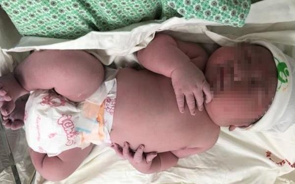 Vua chao doi, be trai Ha Noi to bang tre 3 thang tuoi hinh anh