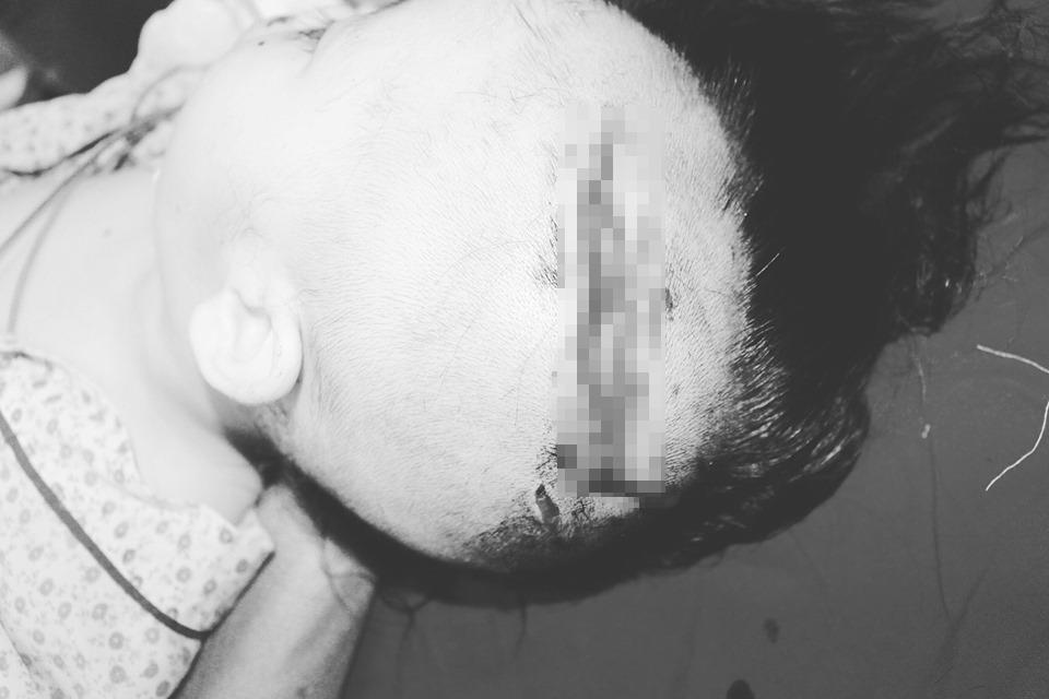 Cháu bé bị chó tấn công ảnh 1 Chau be bi cho tan cong anh 1