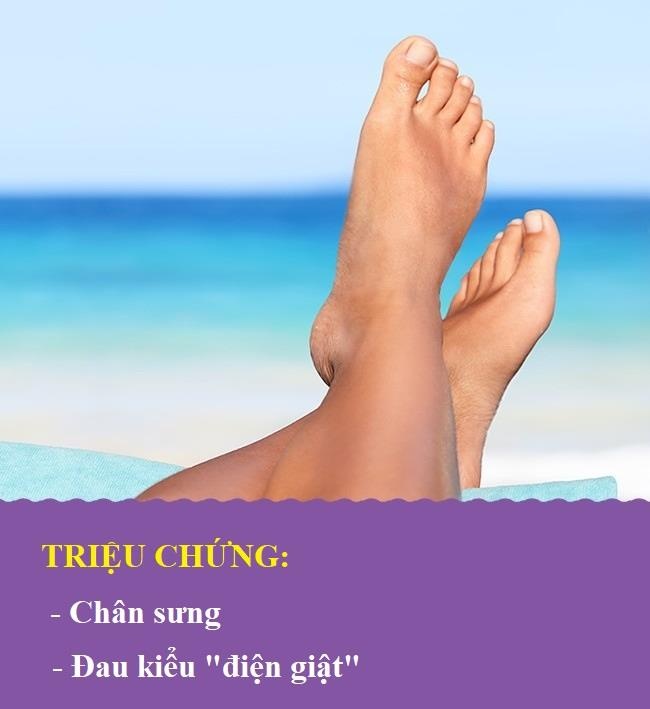 Bat thuong o chan anh 1