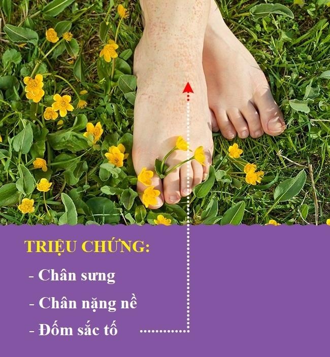 Bat thuong o chan anh 2