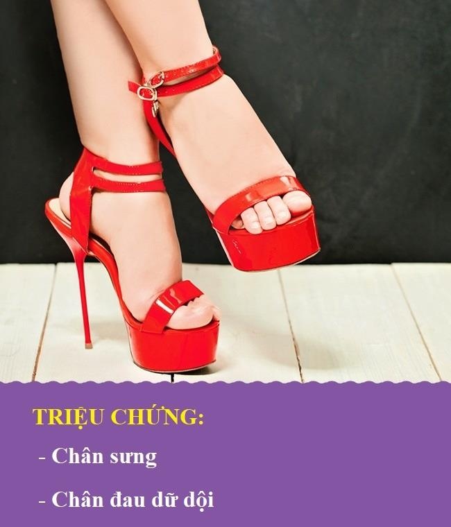 Bat thuong o chan anh 3