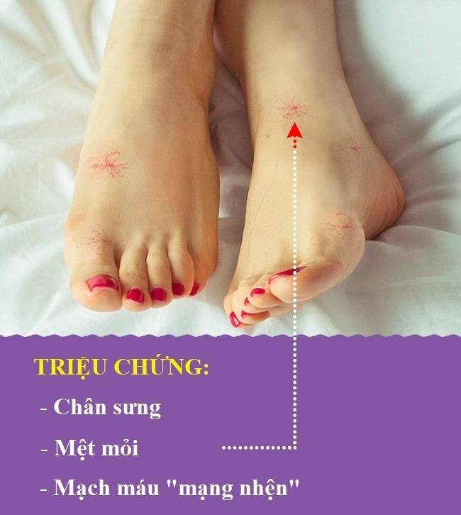 Bat thuong o chan anh 5