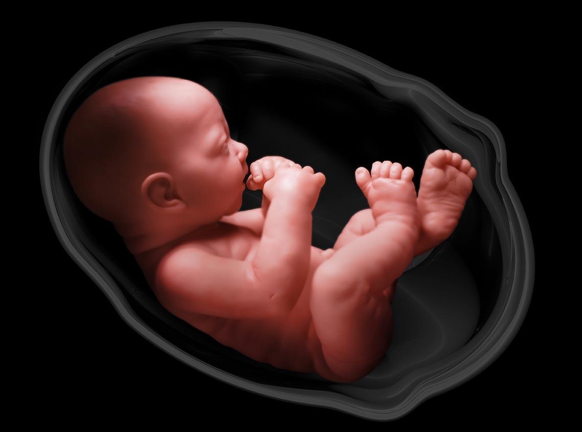Nhầm giới tính vì dị tật vùng kín ảnh 1 Nham gioi tinh vi di tat vung kin anh 1