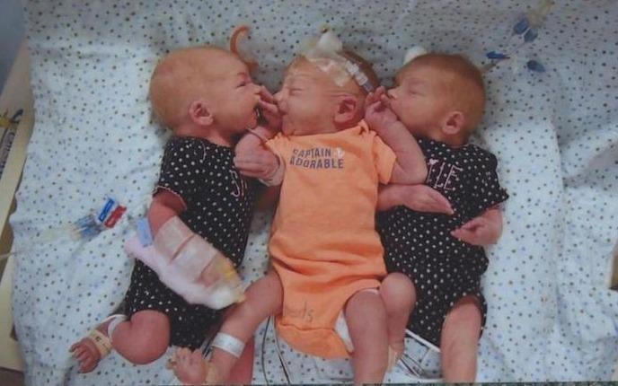 Tuong dau bung vi soi than, ba me bat ngo sinh ba hinh anh