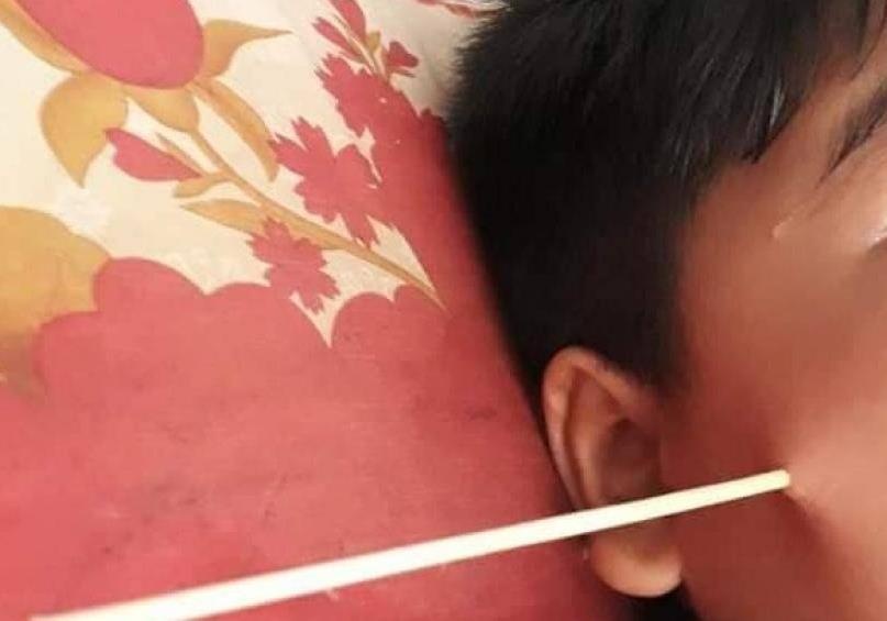 Hoc sinh lop 4 bi que xien dam thung mat khi dang no dua voi ban hinh anh