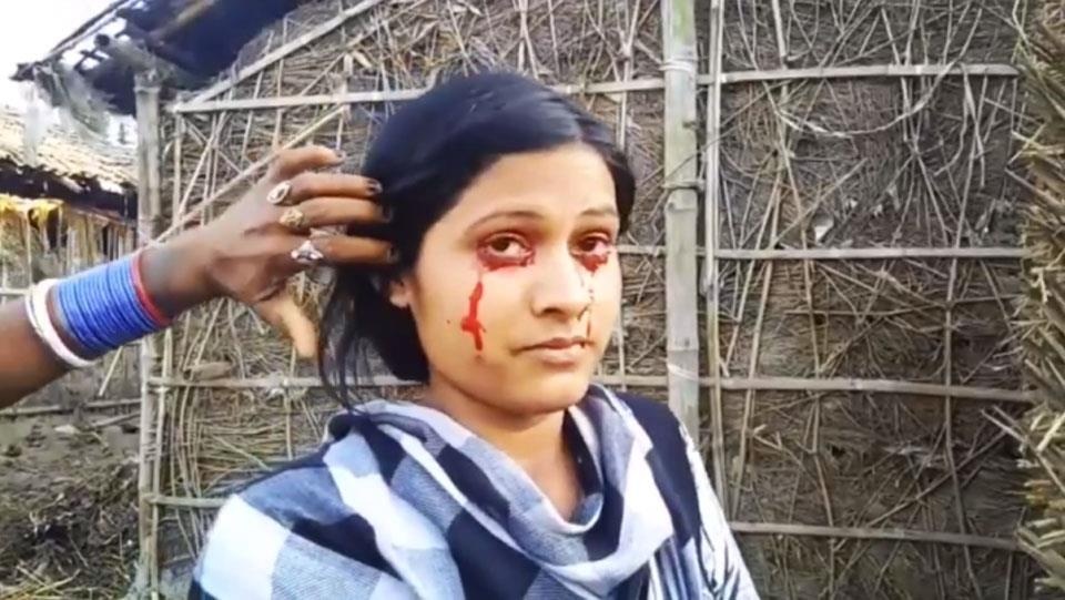 Hoi chung do mo hoi mau anh 1