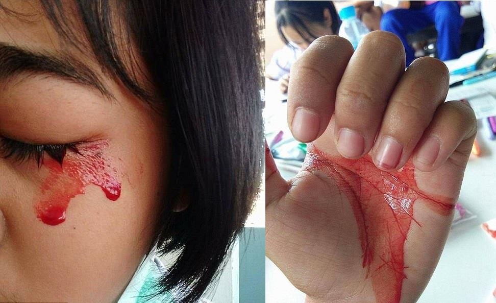 Hoi chung do mo hoi mau anh 2