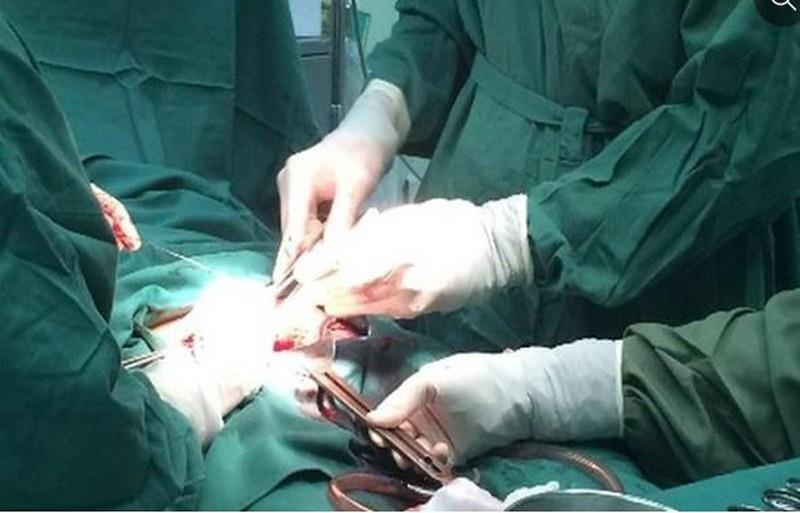 Tân trang "cậu nhỏ" ảnh 1 Tan trang "cau nho" anh 1