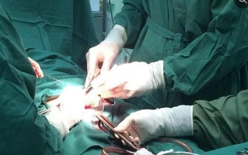 Thuc hu ky thuat tan trang 'cau nho' tang ban linh quy ong hinh anh