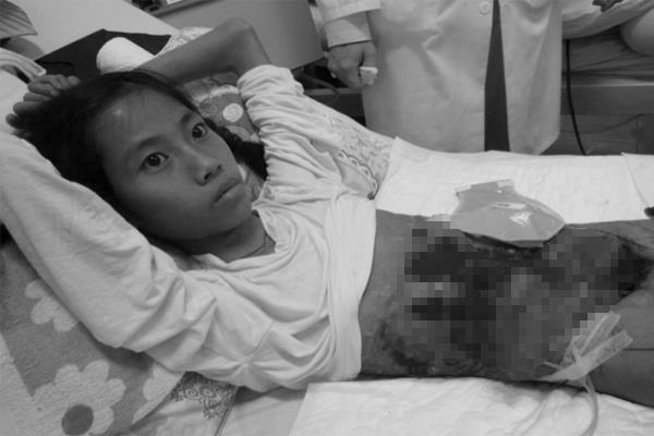 Cô gái từng dùng vải che nội tạng ảnh 1 Co gai tung dung vai che noi tang anh 1