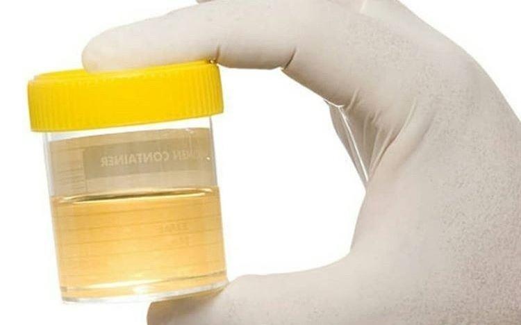 Thay giao pha nuoc tieu ep hoc sinh uong chua benh hinh anh