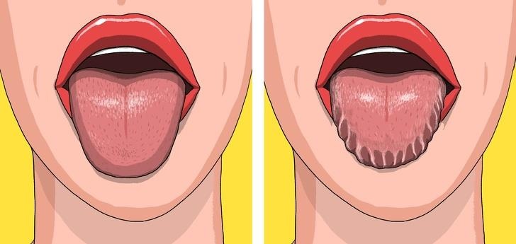 Dau hieu bat thuong tren co the anh 1