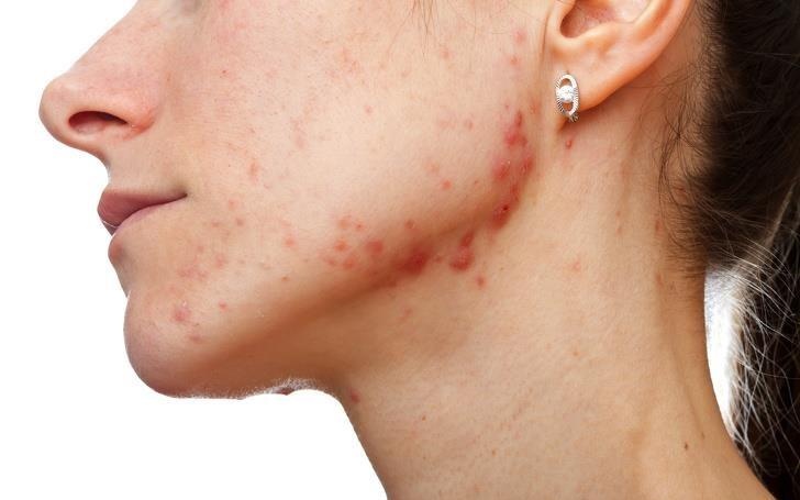 7 dau hieu tren co the tiet lo suc khoe co van de hinh anh