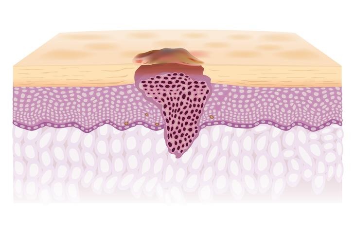 Dau hieu bat thuong tren co the anh 6