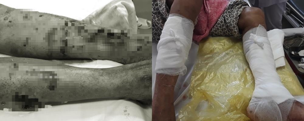 chó cắn ảnh 1 cho can anh 1