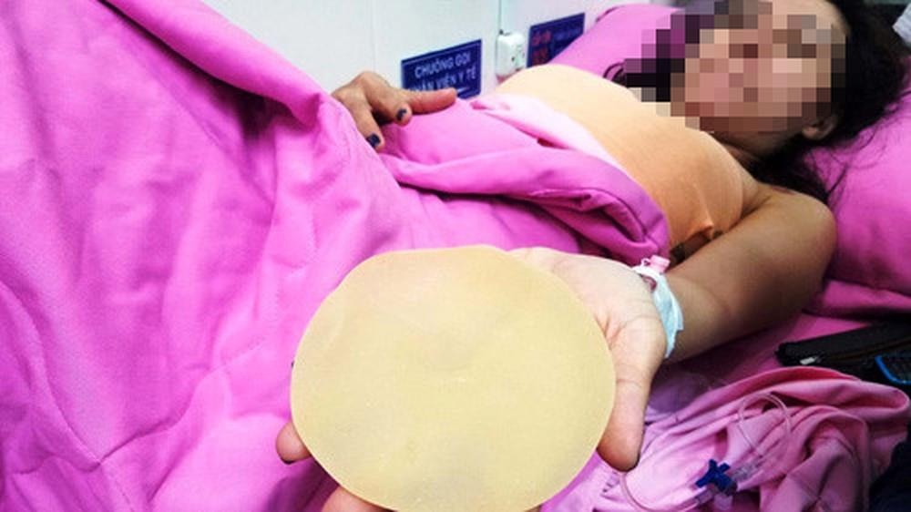 Nhung chuyen bi hai mang ten tui nguc silicone hinh anh