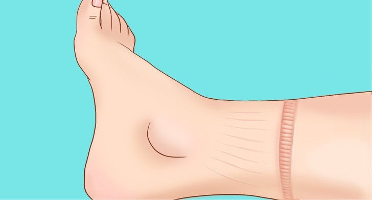 Trieu chung canh bao benh tim anh 3