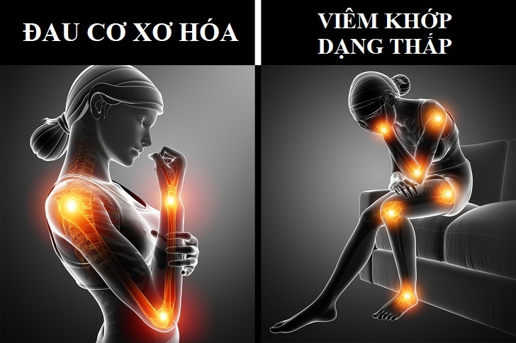 Viem vu va ung thu vu anh 2