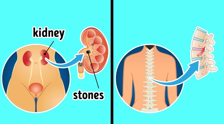 Viem vu va ung thu vu anh 5
