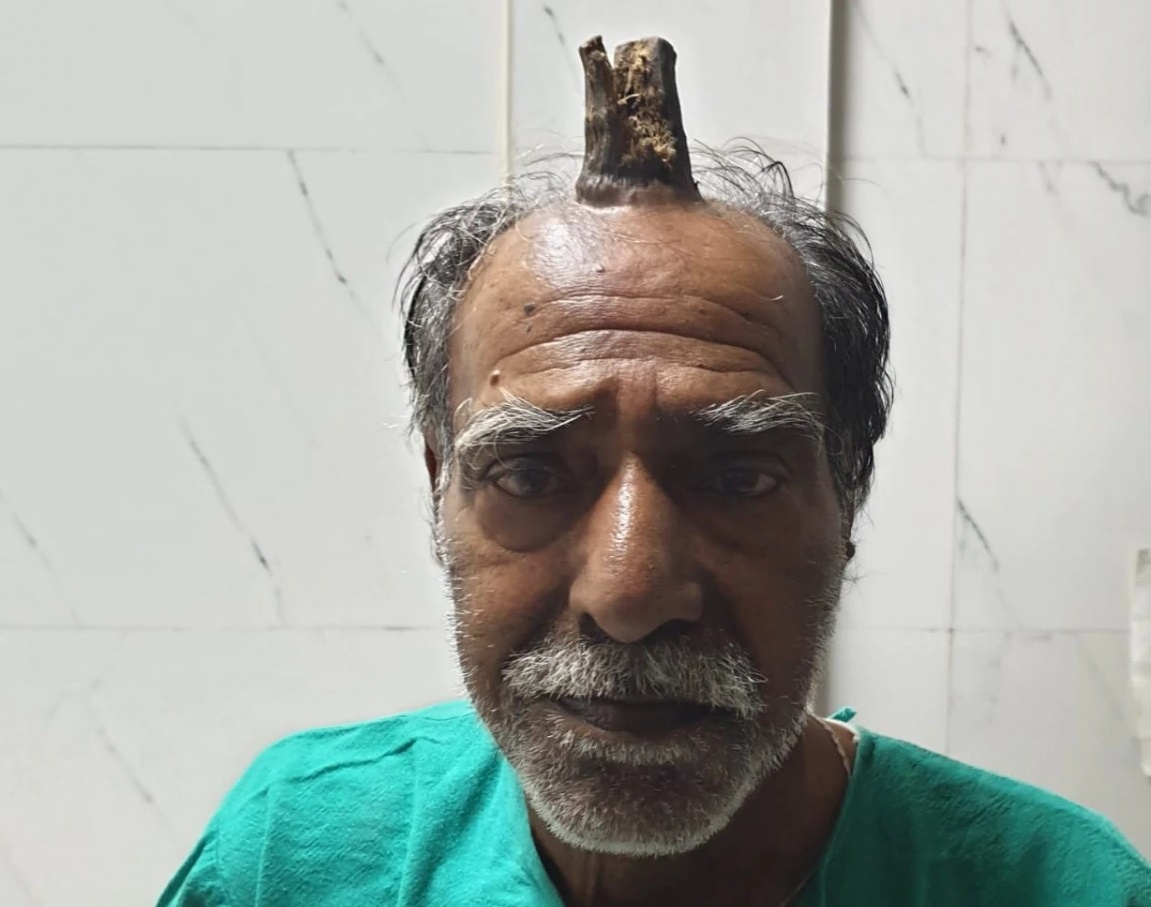 Bi an ve nhung chiec sung ac quy hinh anh