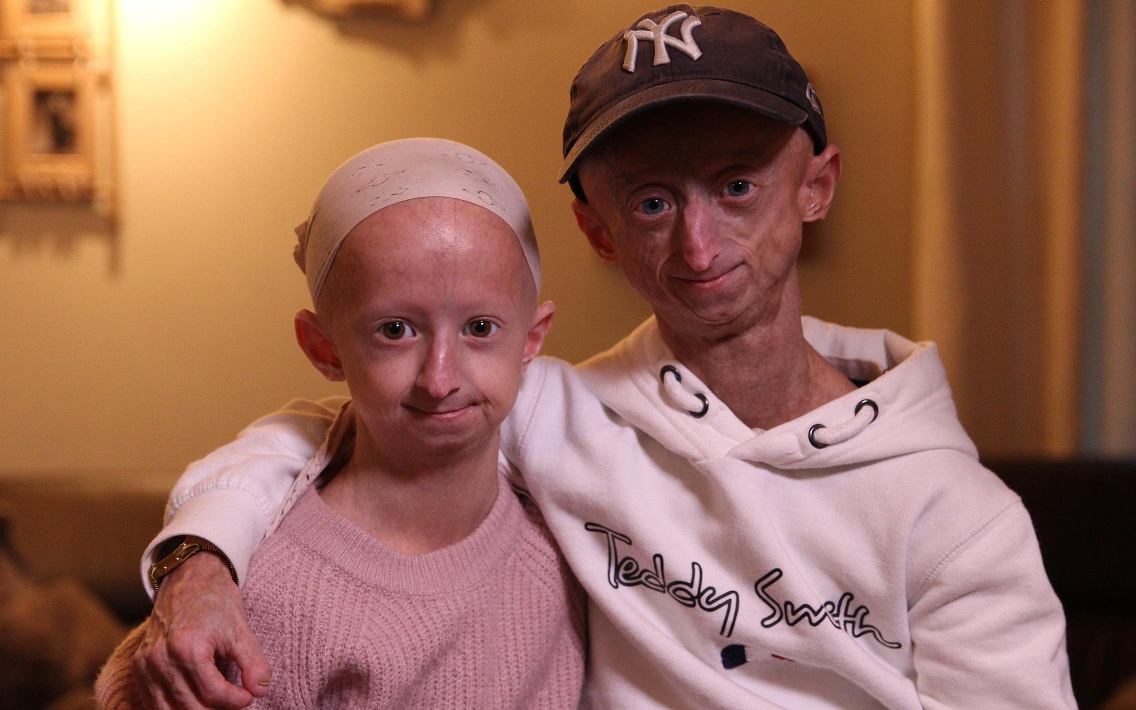 Can benh khien hai anh em ruot gia nhu ong, ba lao hinh anh