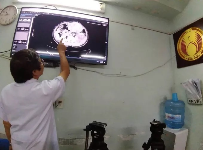 Ba khối u nặng 2, 4 kg ảnh 1 Ba khoi u nang 2, 4 kg anh 1