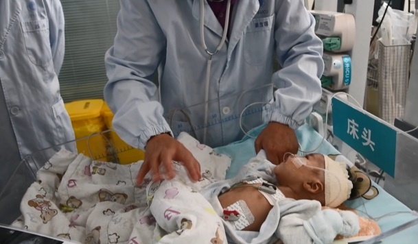 Ghép tim cho bé 66 ngày tuổi ảnh 2 Ghep tim cho be 66 ngay tuoi anh 2