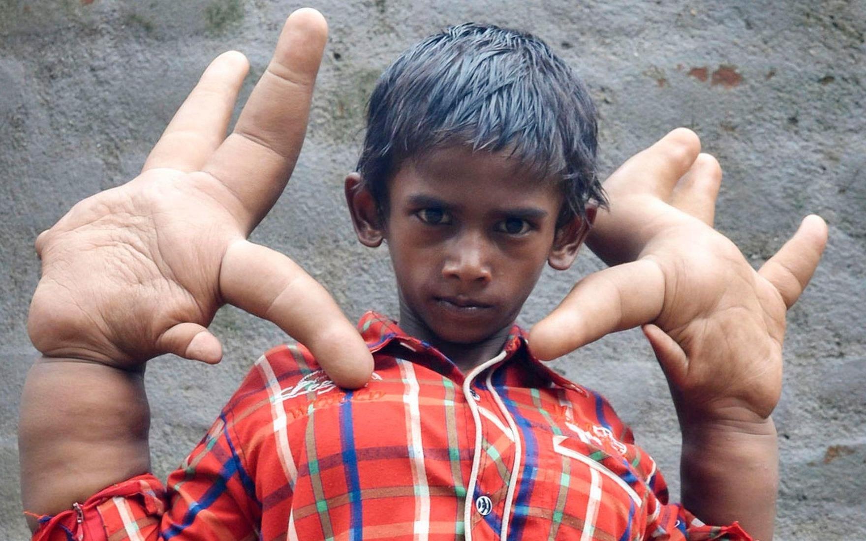 Cau be co doi ban tay khong lo nang 16 kg hinh anh