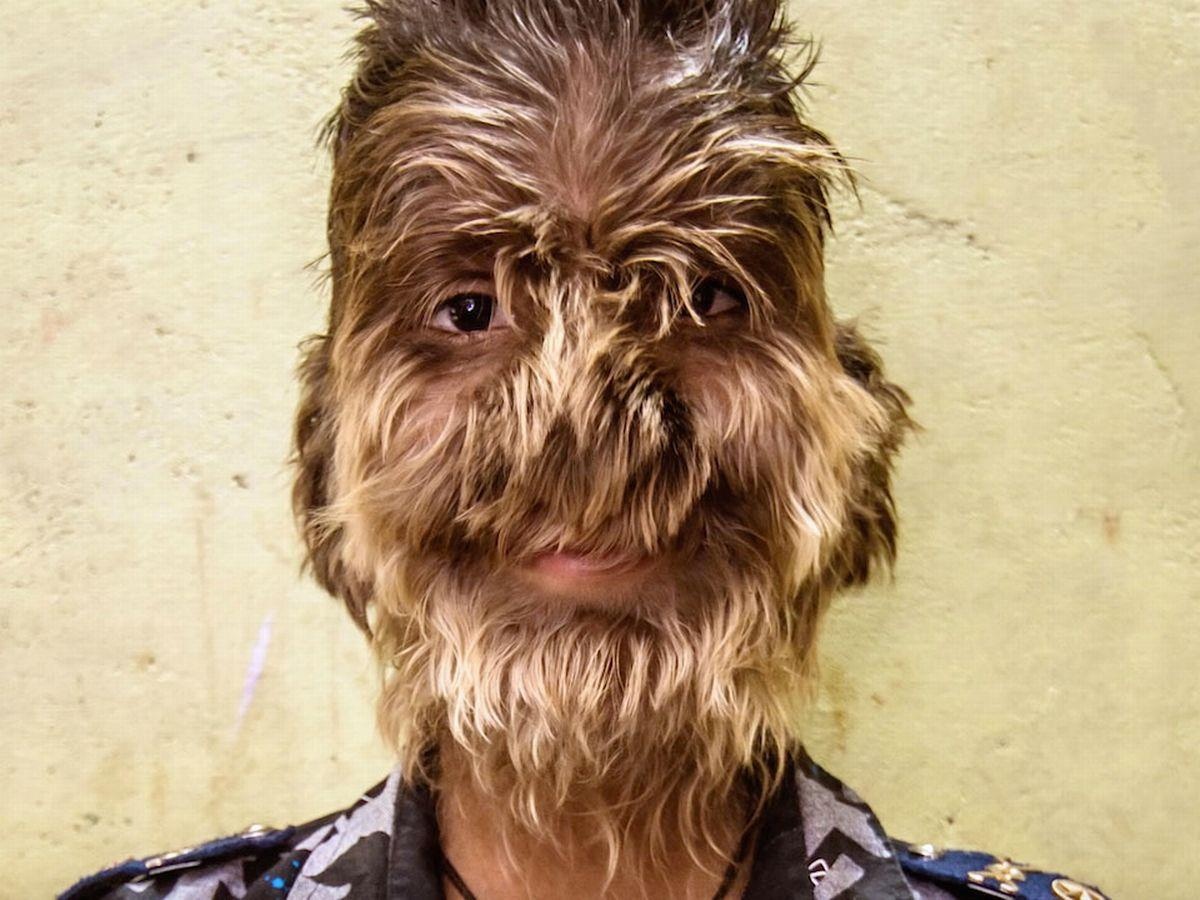 Cuoc song cua cau be mac hoi chung 'nguoi soi' hinh anh