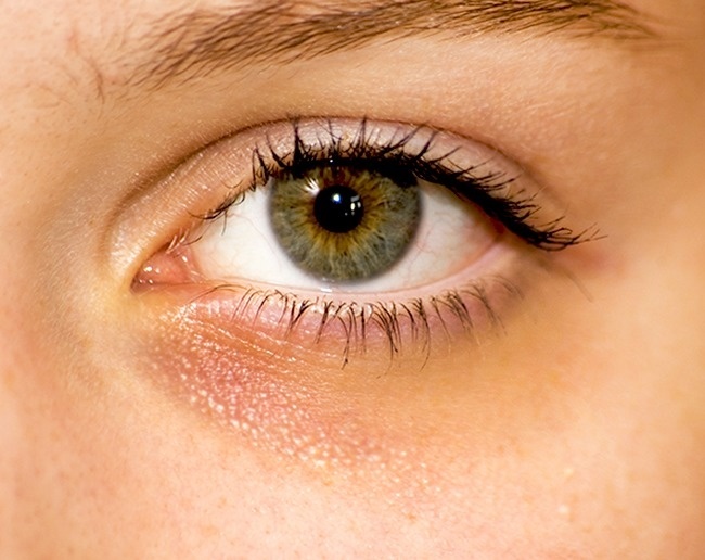 Dau hieu nguy hiem cua co the anh 1