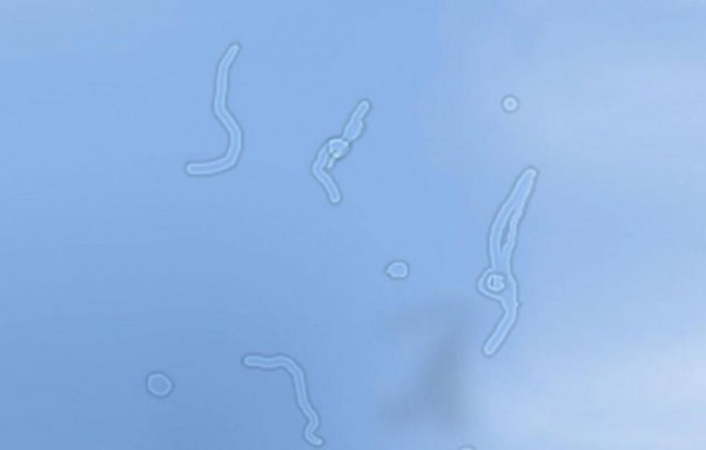 Dau hieu nguy hiem cua co the anh 4