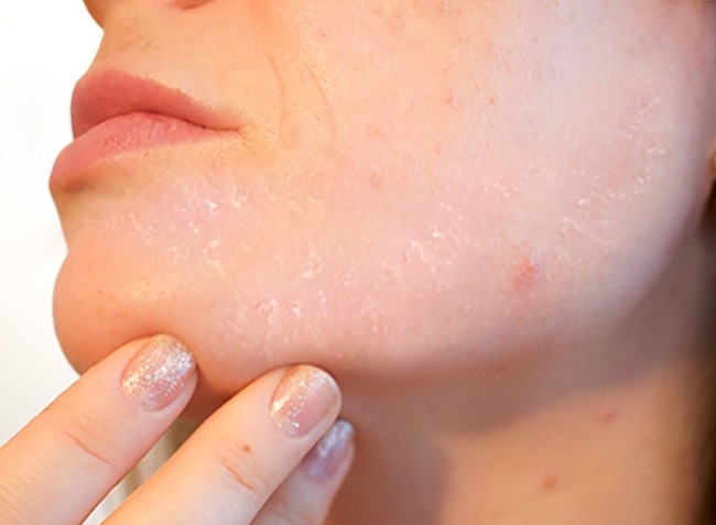 Dau hieu nguy hiem cua co the anh 6