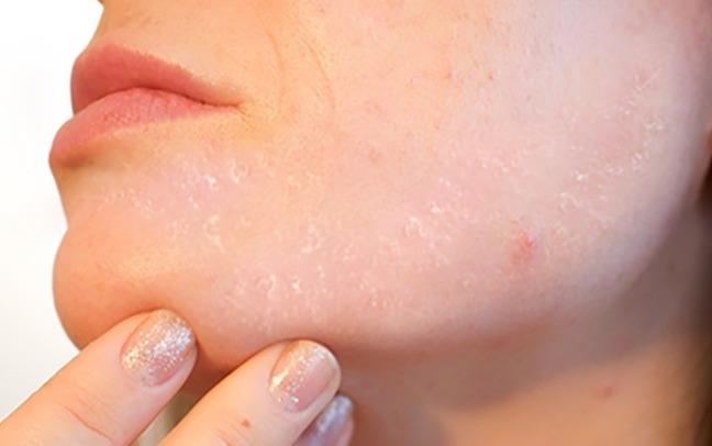 8 dau hieu tuong vo hai nhieu nguoi thuong phot lo hinh anh