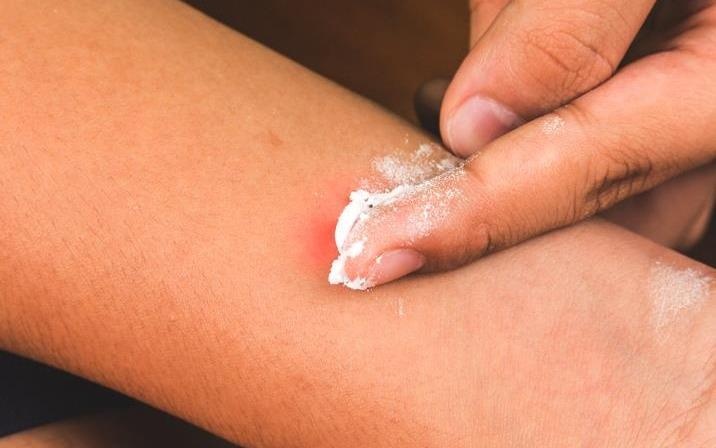 Nhan biet va xu ly ton thuong do doc to tu kien ba khoang hinh anh