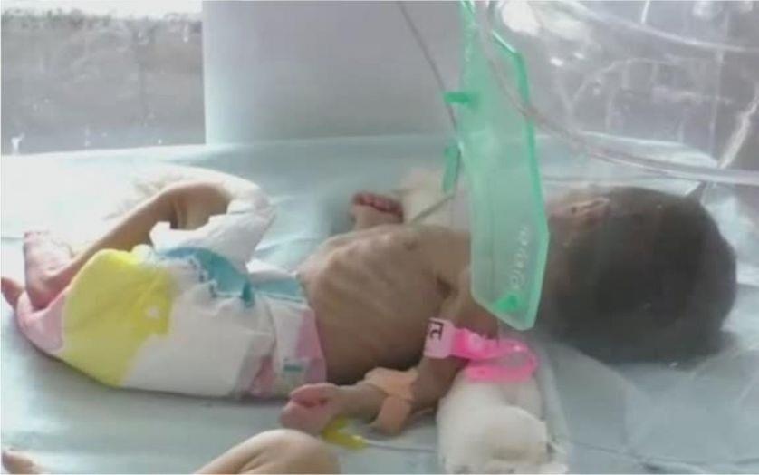 Be gai so sinh bi chon song o An Do hinh anh