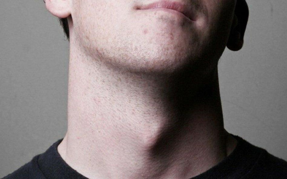 Tai sao nam gioi lai co 'qua tao cua Adam'? hinh anh